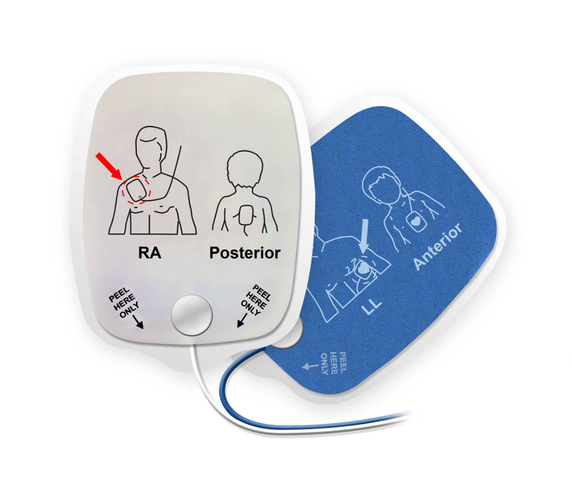 Defibrillation Pads and Electrodes